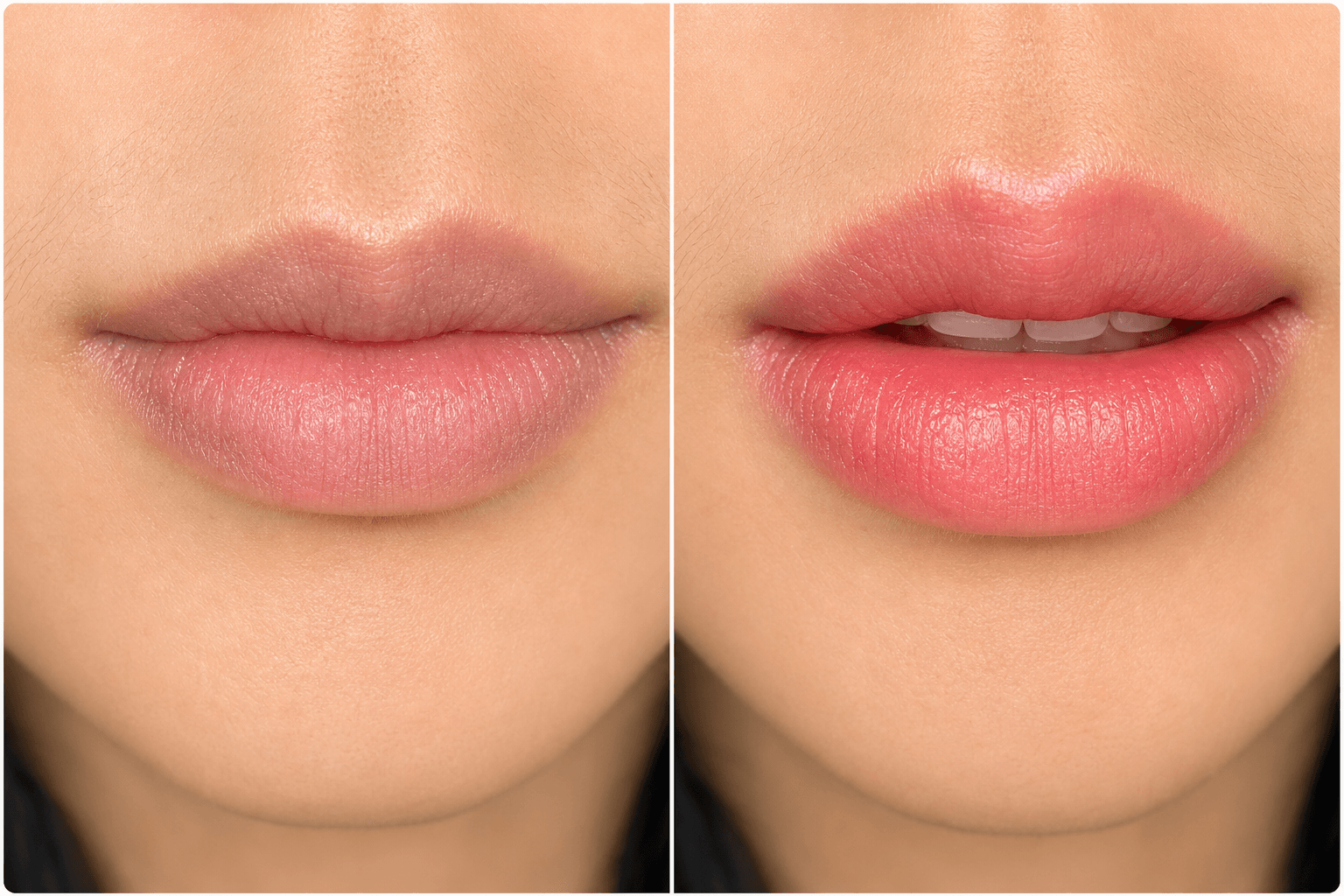 Kết quả môi trước và sau tại HAN Beauty Center